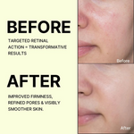 Thumbnail for Celimax The Vita-A Retinal Shot Tightening Booster For Anti-Aging, Dark Spots & Wrinkles - Distacart