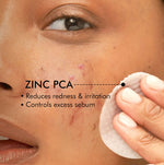 Thumbnail for mCaffeine 2% Salicylic Acid Serum Clear Skin Acne Pads - Acne & Oil Control with Matcha Tea - Distacart