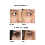 Thumbnail for Skog Under Eye Repair Oil