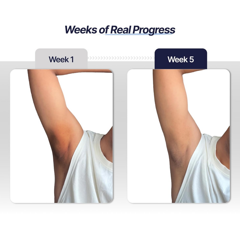 Mannlich Underarm Roll-On for Men - Dista