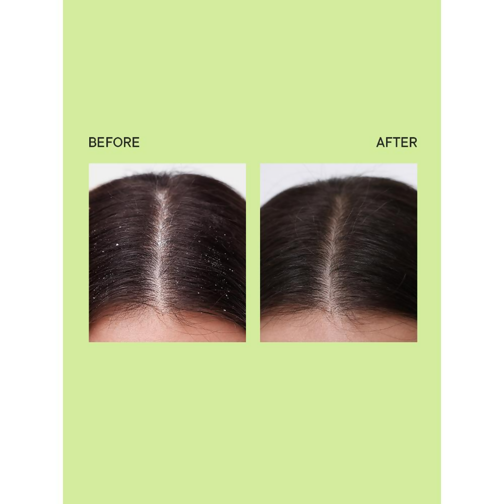 Quench Anti Dandruff Shampoo - Distacart