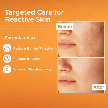 Brinton Uv Doux Restore Moisturizer - Dista