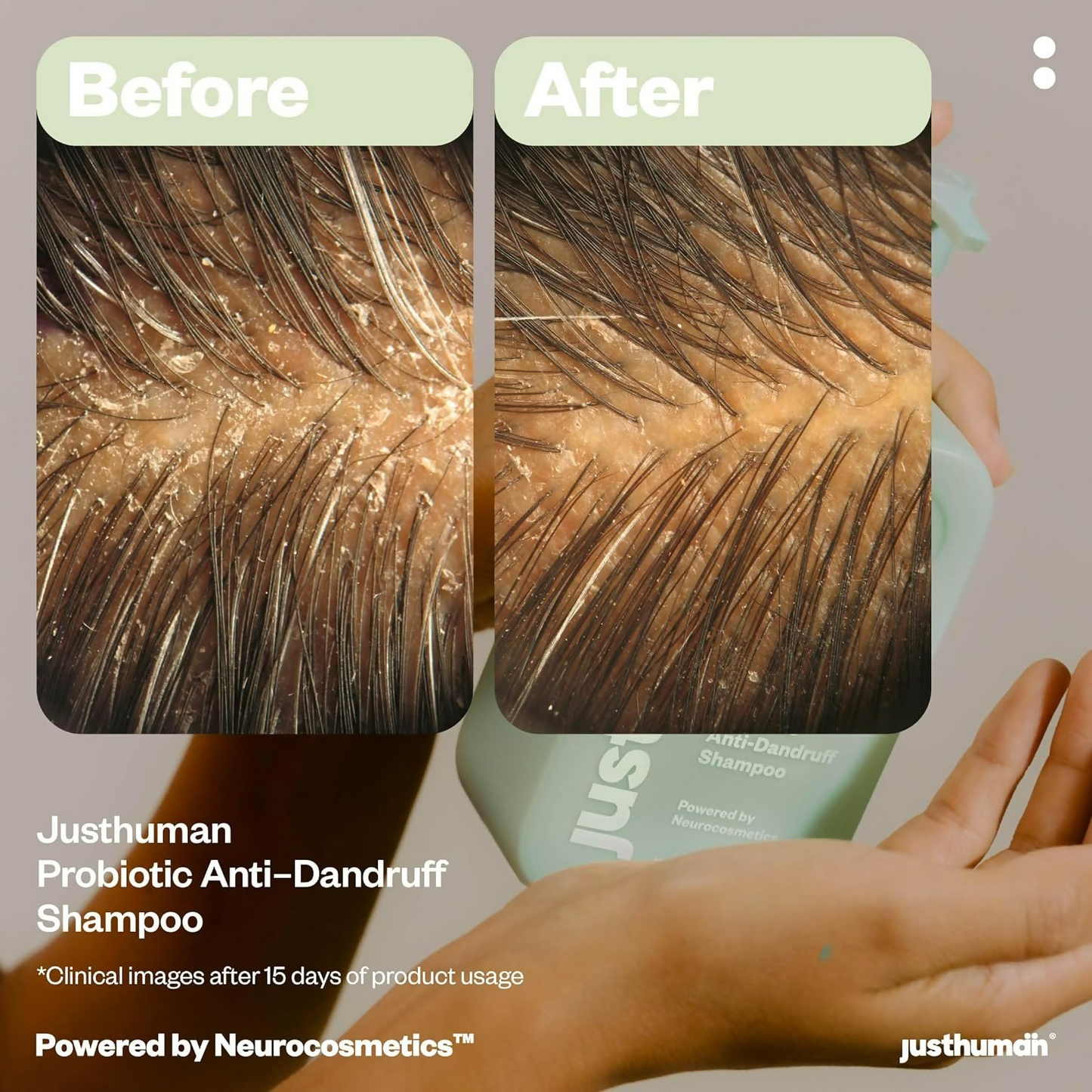 JustHuman Probiotic Anti Dandruff Shampoo - Distacart