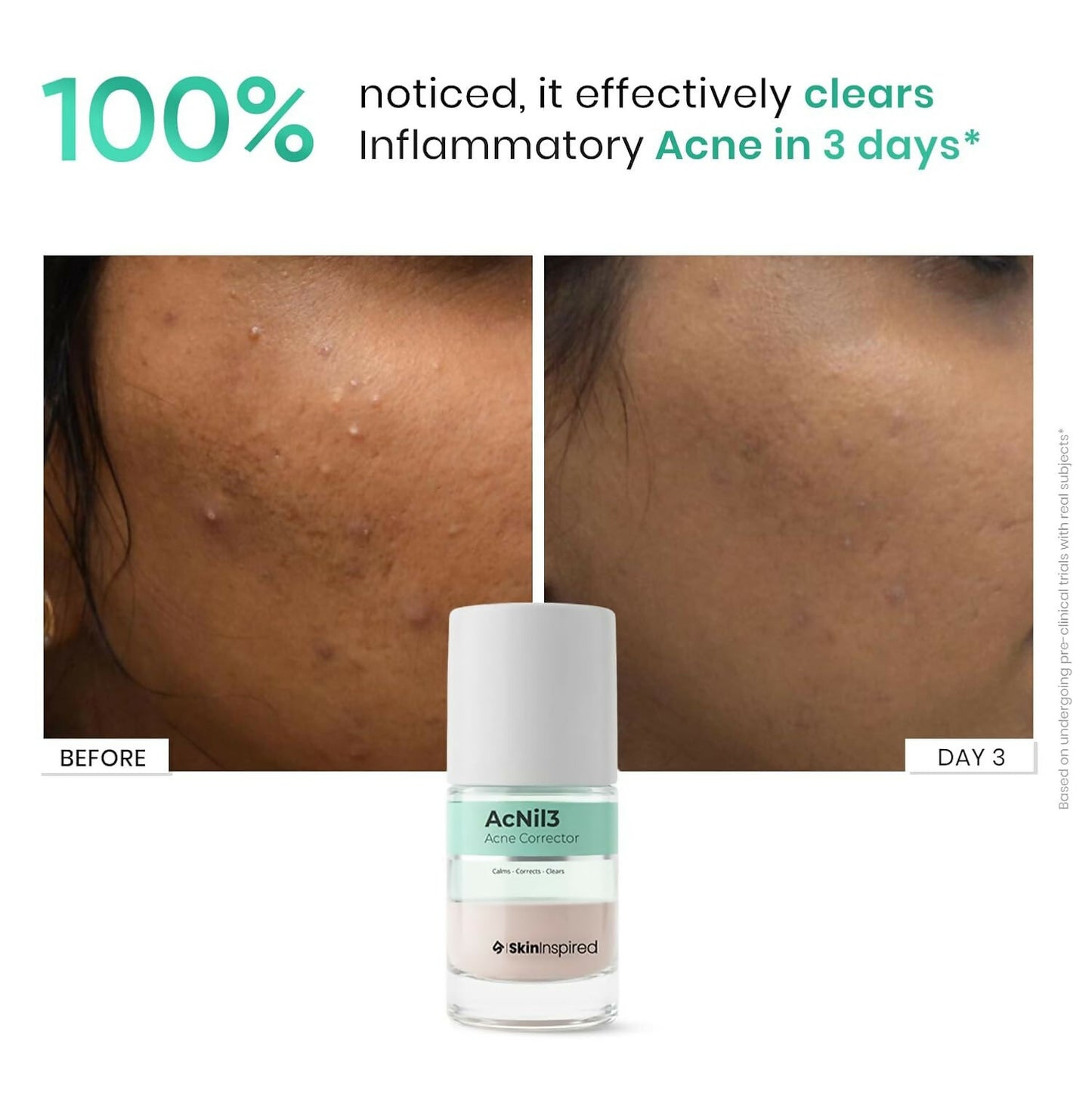 SkinInspired AcNil3 Rapid Spot Corrector - Distacart