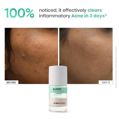 SkinInspired AcNil3 Rapid Spot Corrector - Distacart