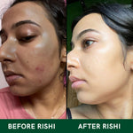 Thumbnail for Copy of SKIN GLOW TEA BEFORE AFTER
