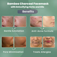 Thumbnail for Wild Oak Niacinamide Bamboo Charcoal Face Mask - Distacart