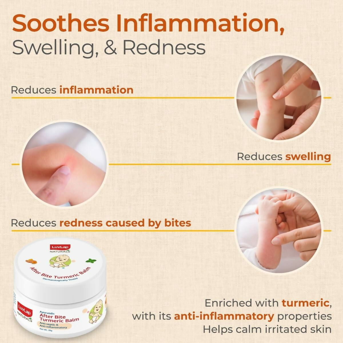 LuvLap Naturals After Bite Turmeric Balm with Pudina - Distacart
