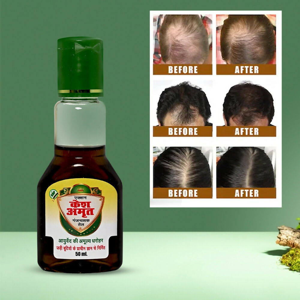 Action Pharma Kesh Amrit Ganjnashk Oil