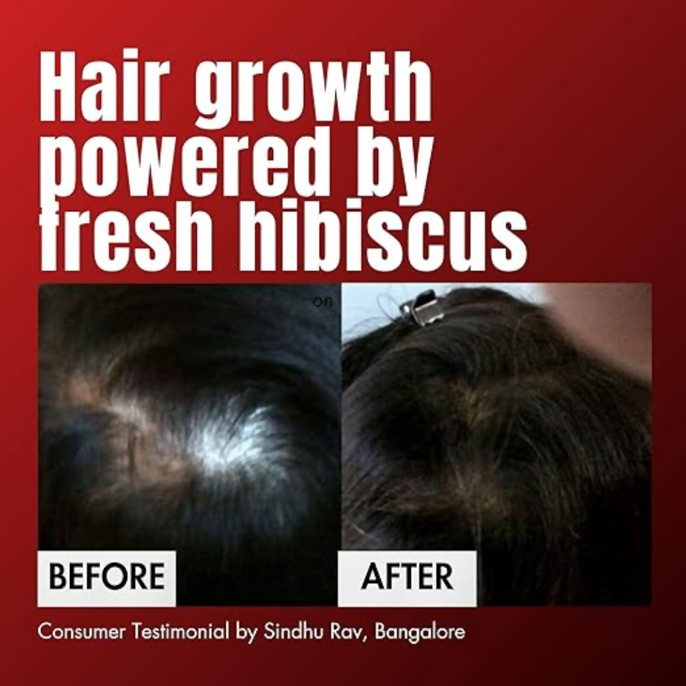 Hibiscus Monkey HM Love Scalp & Hair Oil - Dista