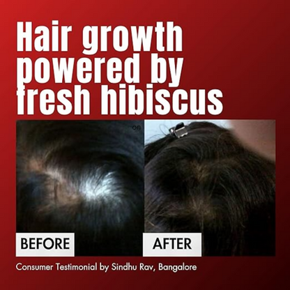 Hibiscus Monkey HM Love Scalp & Hair Oil - Dista