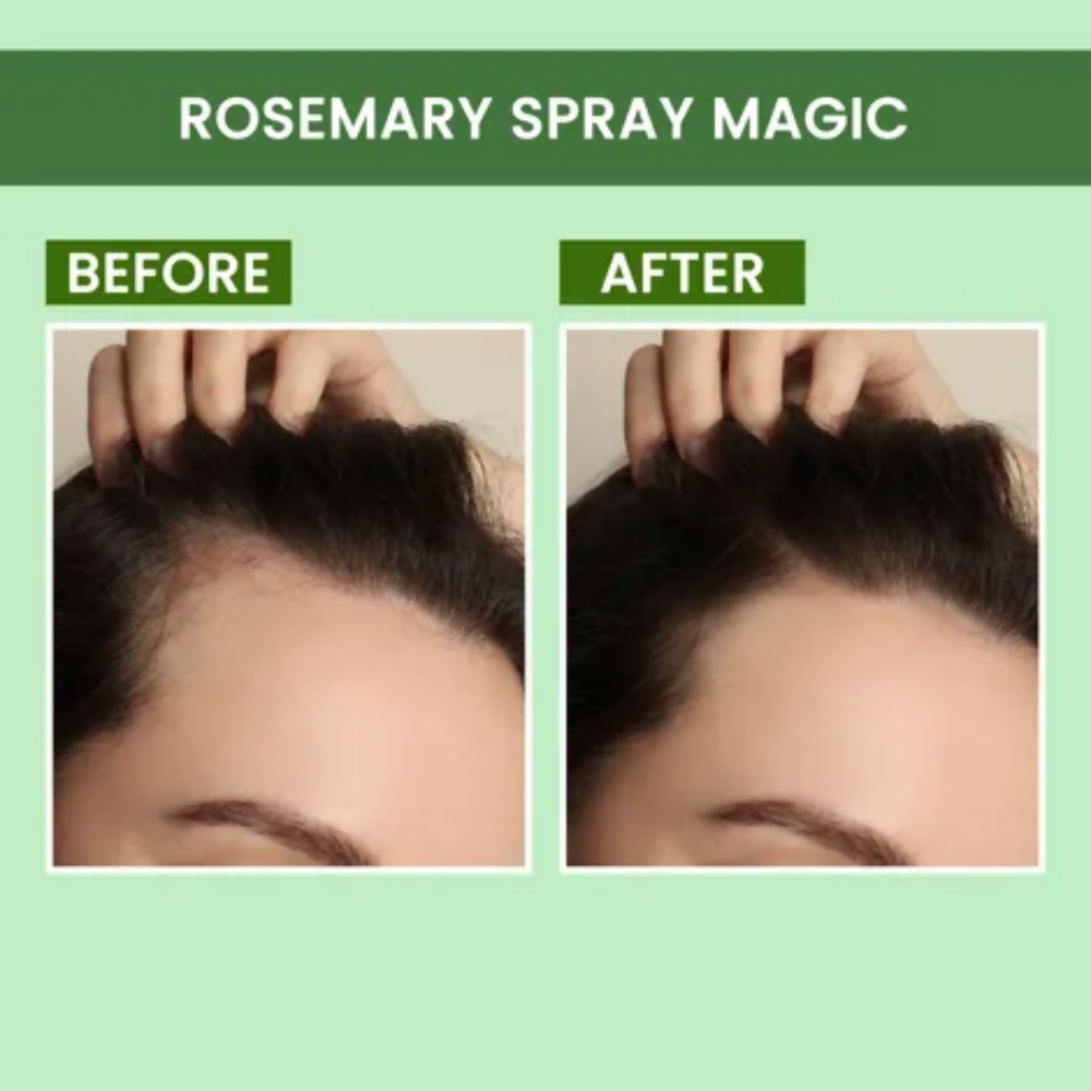Alps Goodness Rosemary Revive Kit - Distacart