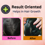 Thumbnail for Curista Naturals Arnica Jaborandi Hair Growth Oil - Dista