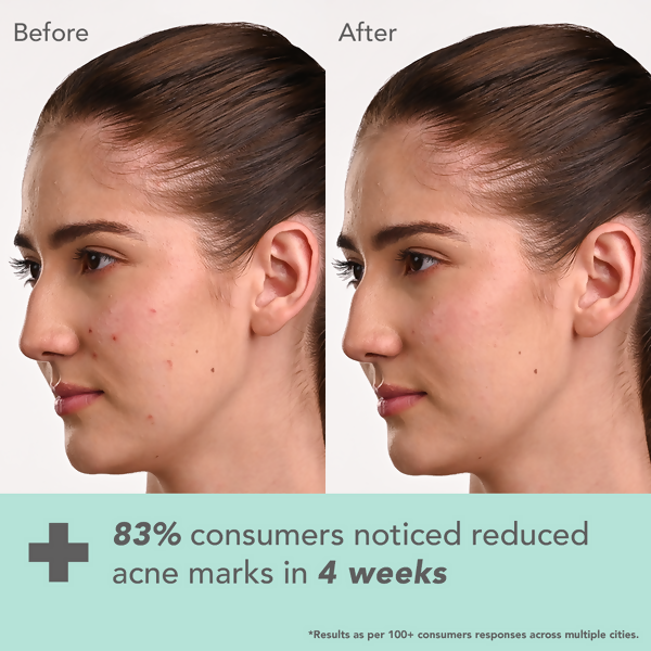 Lotus DermaBotanics Kojic acid + Multi Berry Face Serum - Distacart