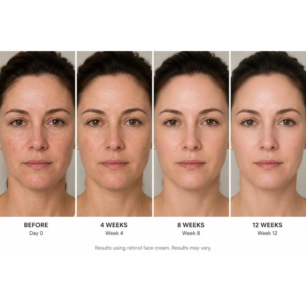 Frabia Retinol 0.1 Night Cream - Dista
