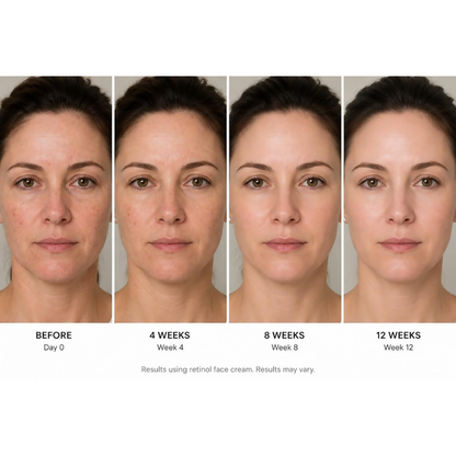 Frabia Retinol 0.1 Night Cream - Dista