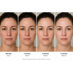 Thumbnail for Frabia Retinol 0.1 Night Cream - Dista