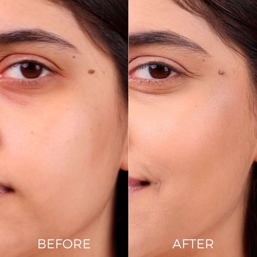 Brillare AHA BHA Exfoliating Face Peeling Solution - Dista