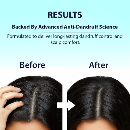 Dermistry Anti-Dandruff Control Shampoo Mask & Serum - Distacart