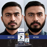Thumbnail for Amazing Earth Certified Organic Beard Growth Oil