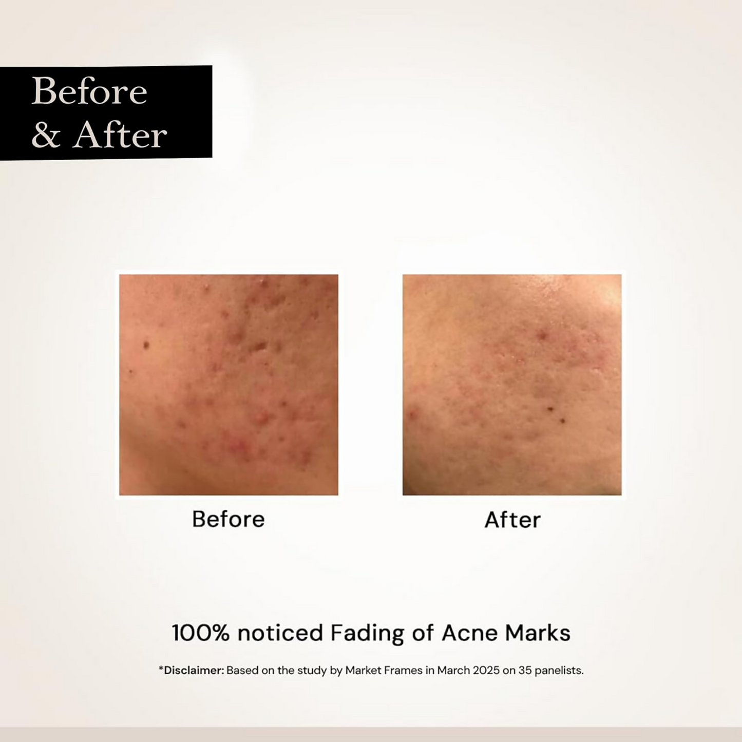 Milky Moon Face Glow Night Serum Dark Spot & Brightening Face Serum - Dista