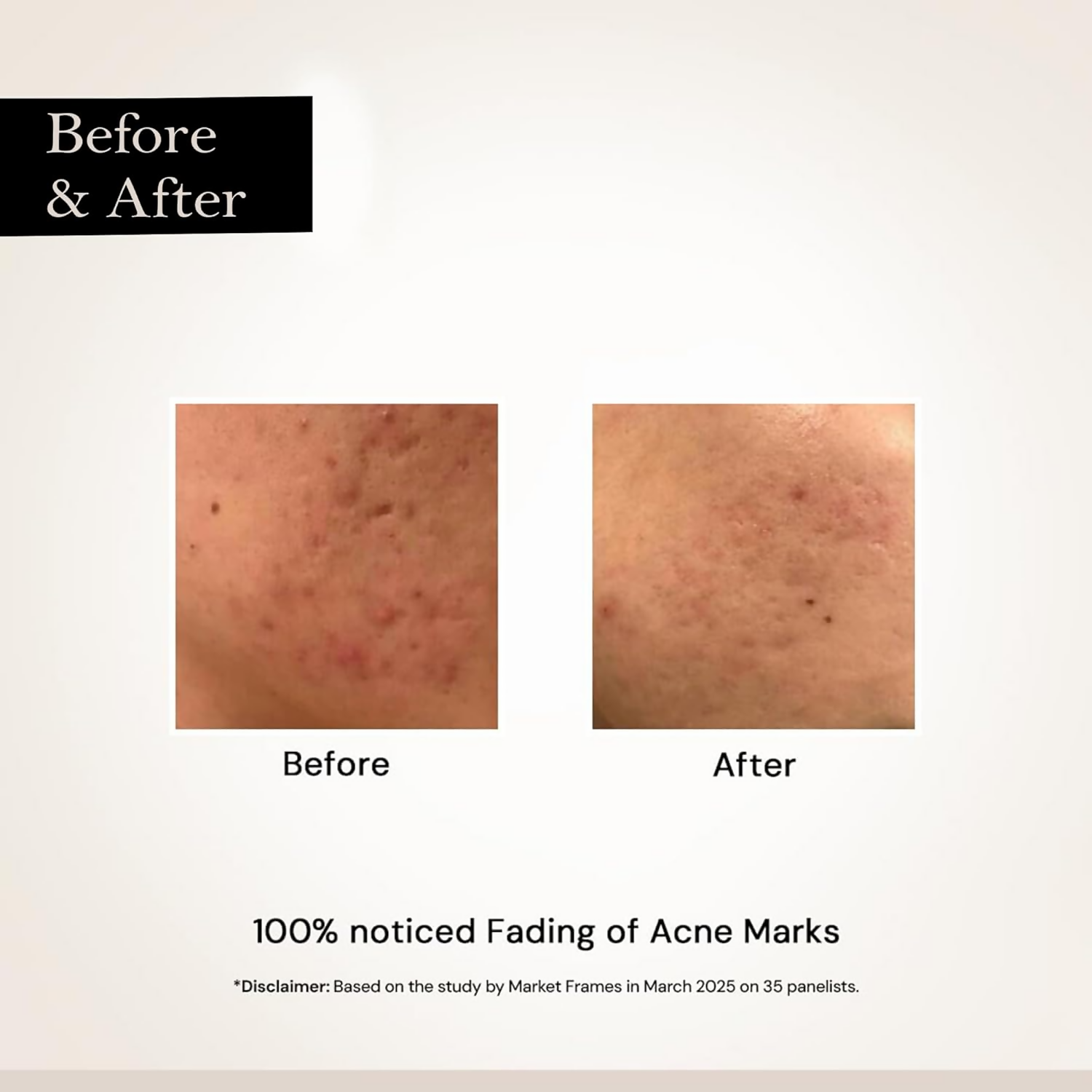 Milky Moon Face Glow Night Serum Dark Spot & Brightening Face Serum - Dista