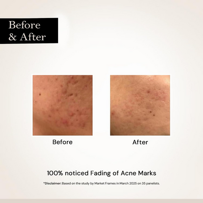 Milky Moon Face Glow Night Serum Dark Spot & Brightening Face Serum - Dista