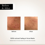 Thumbnail for Milky Moon Face Glow Night Serum Dark Spot & Brightening Face Serum - Dista