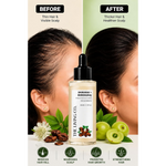 Thumbnail for THE LIVING CO. Shikakai + Bhringraj Stimulating Scalp Serum - Dista