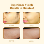 Thumbnail for Wipness Natural Chocolate Facial Hair Removal Powder - Dista