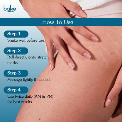 Bake StriErase™ Stretch Marks Removal Roll-On Serum - Distacart