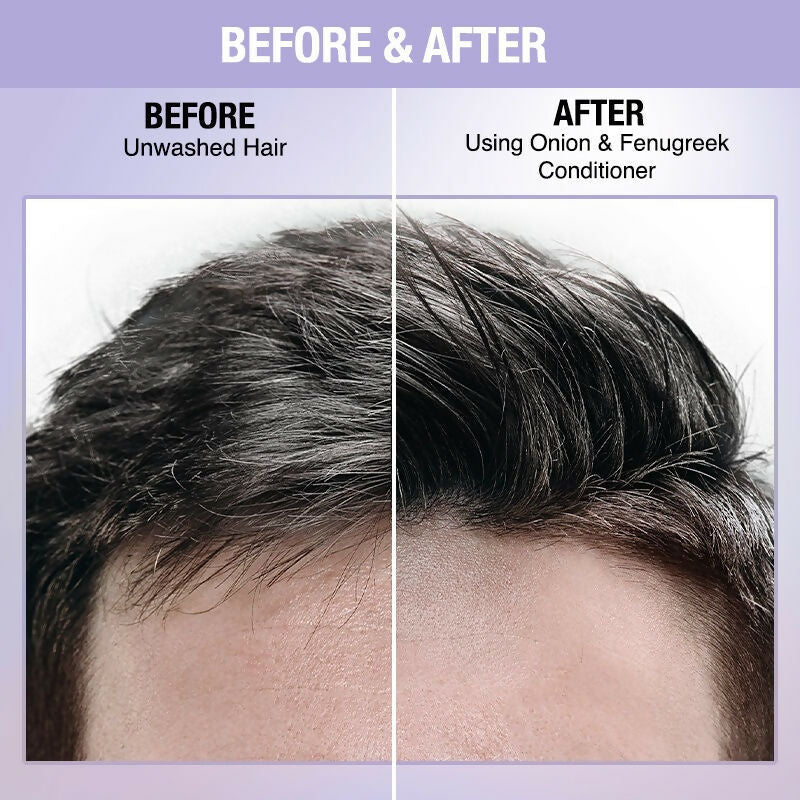 Nykaa Naturals Anti-Hair Fall -Free Conditioner With Onion & Fenugreek - Limited Time Offer