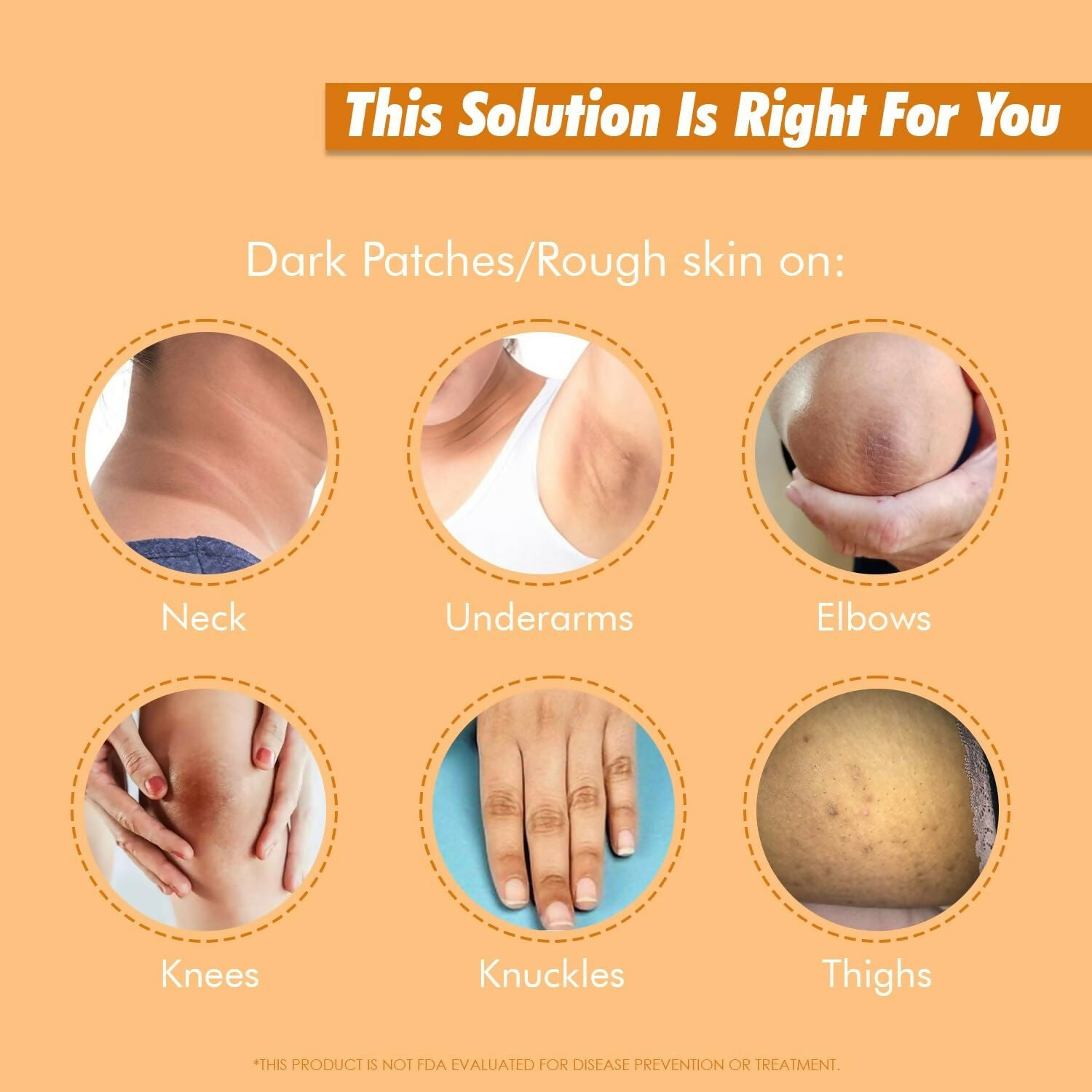 Exposed Whitening Cream For Intimate Areas Dark Underarms Elbows, Neck - Distacart