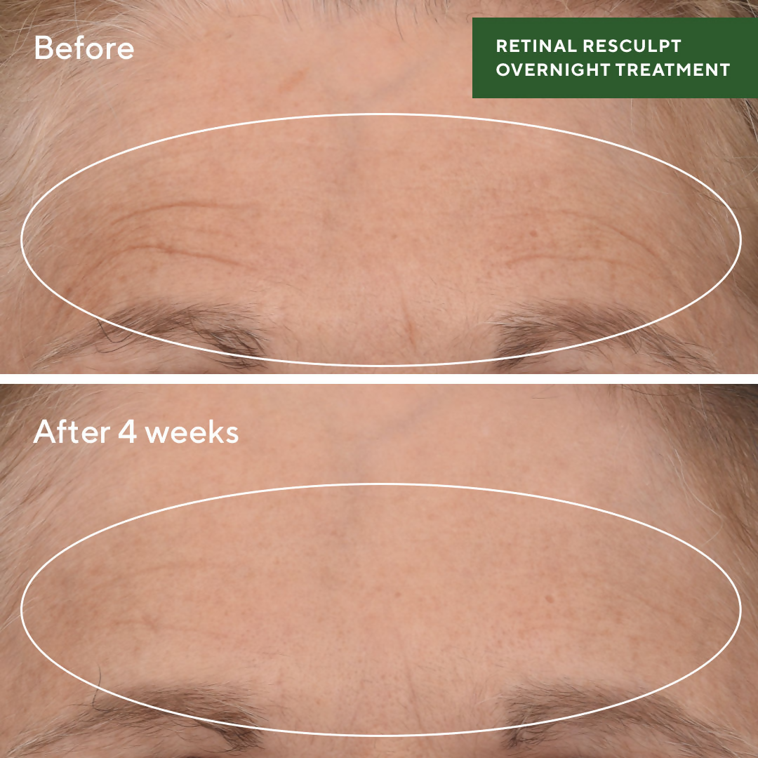 Murad Retinal ReSculpt Overnight Treatment - Distacart