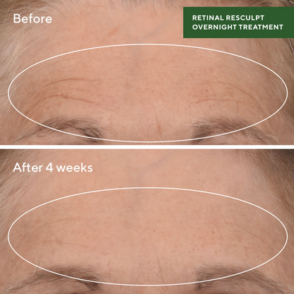 Murad Retinal ReSculpt Overnight Treatment - Distacart