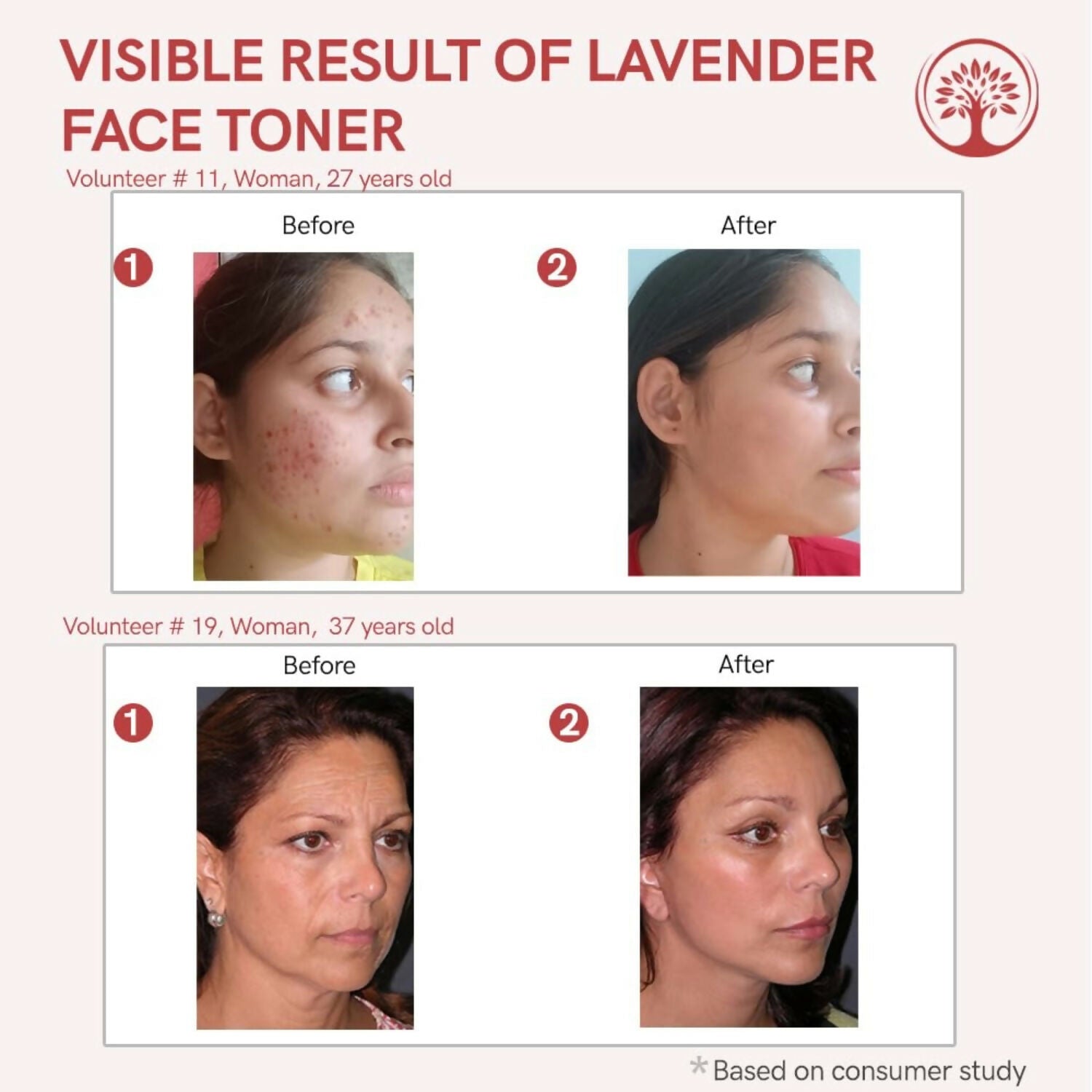 Ivory Natural Lavender Facial Toner For Acne, Even Skin Tone - Distacart