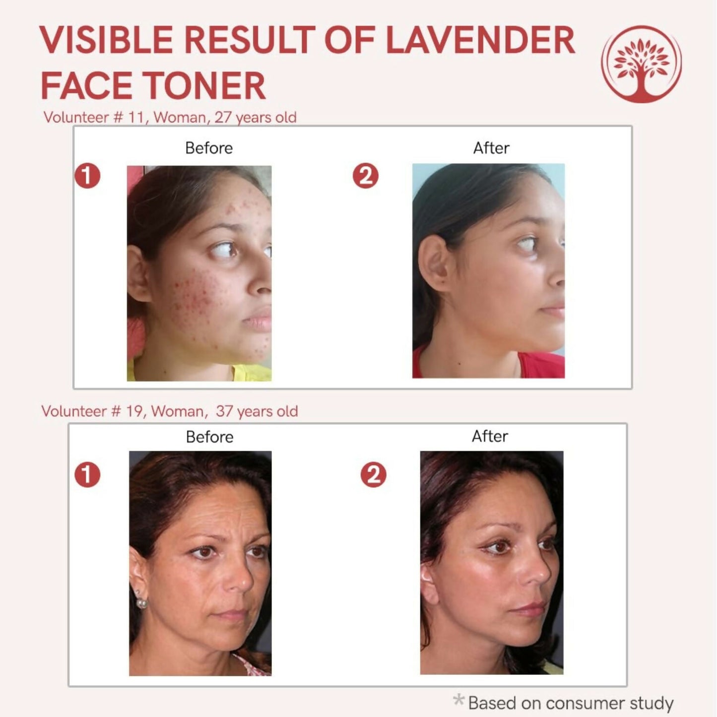Ivory Natural Lavender Facial Toner For Acne, Even Skin Tone - Distacart