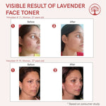Thumbnail for Ivory Natural Lavender Facial Toner For Acne, Even Skin Tone - Distacart