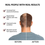 Thumbnail for Beauty Secrets Saw Palmetto Hair Growth Serum - Distacart