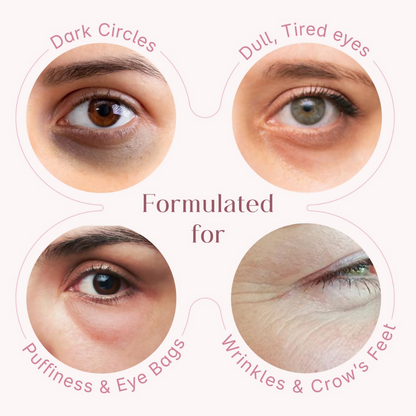 Seoulskin Under Eye Cream - Distacart