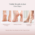 Thumbnail for Seoulskin Glycolic Acid Foot Peeling Mask - Distacart