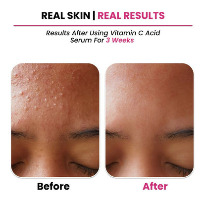 Thriveco 10% Vitamin C+ Hyaluronic Acid Serum - Distacart