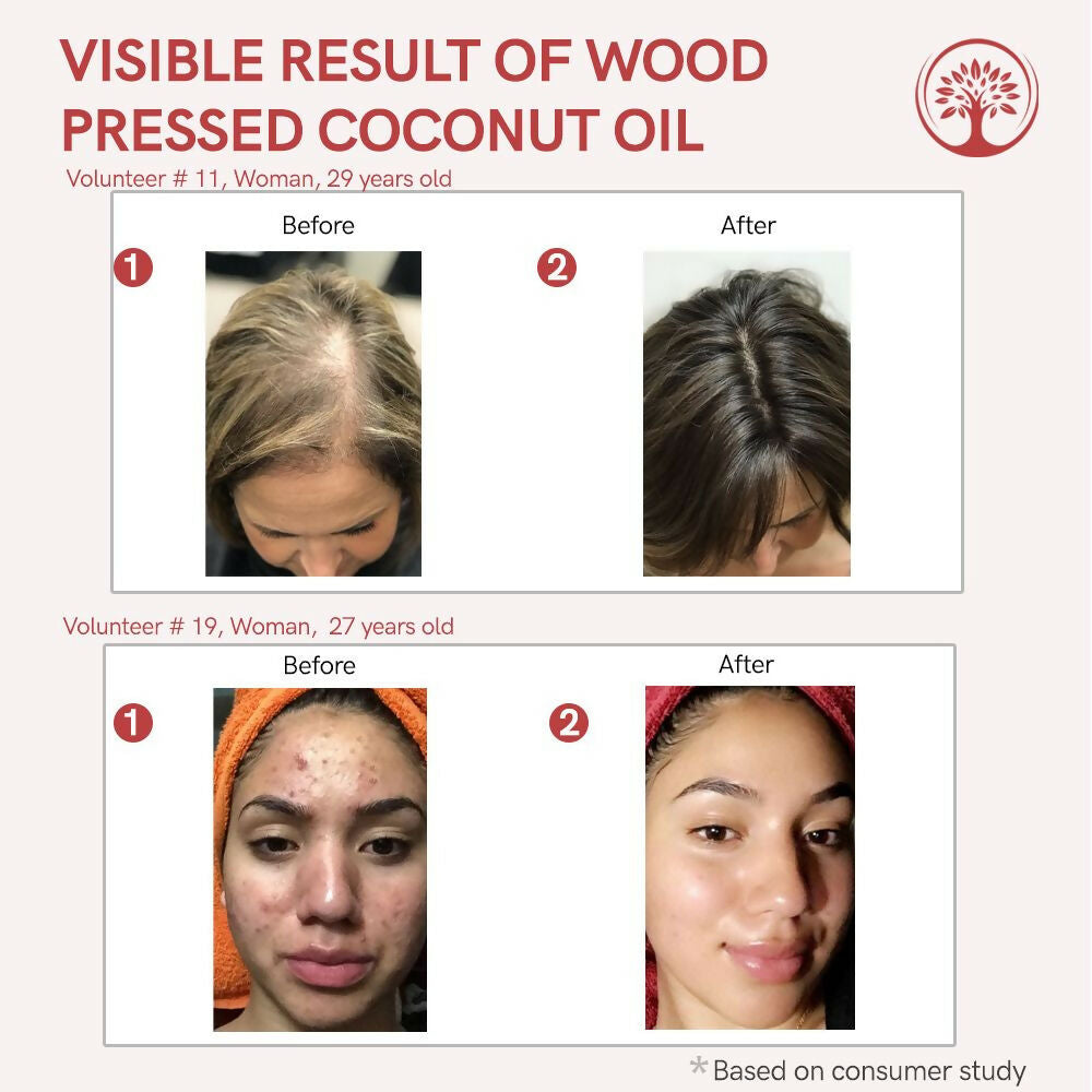 Ivory Natural Wood Pressed Organic Coconut Oil , Premium Extra Virgin Oil - For Radiant Skin, Hair Wellness & Baby Care - Distacart