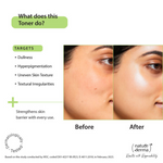 Thumbnail for Nature Derma Glycolic Acid Toner Essence - Distacart