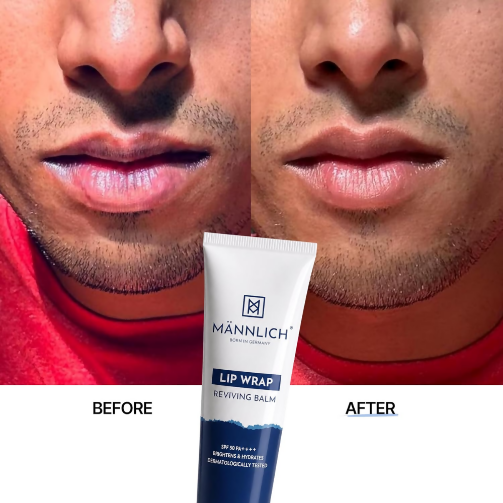 Mannlich Lip Balm For Men - Dista