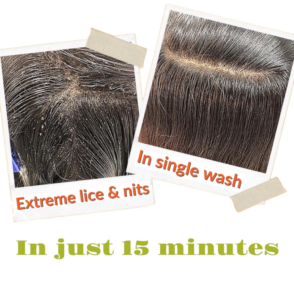 Botanical Luxuriate Tea Tree Anti Lice and Nits Shampoo & Comb - Dista