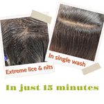 Thumbnail for Botanical Luxuriate Tea Tree Anti Lice and Nits Shampoo & Comb - Dista