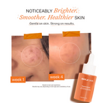 Thumbnail for Bayla Skin Peach & 2% Alpha Arbutin Triple-Action Face Serum - Dista