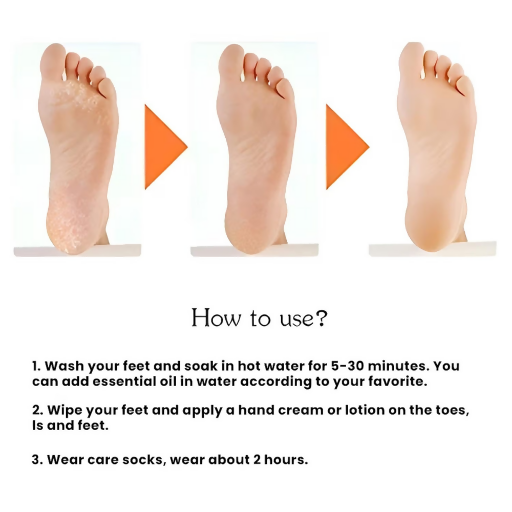 Bronson Professional Smiling Foot Anti Crack Silicone Socks - Dista
