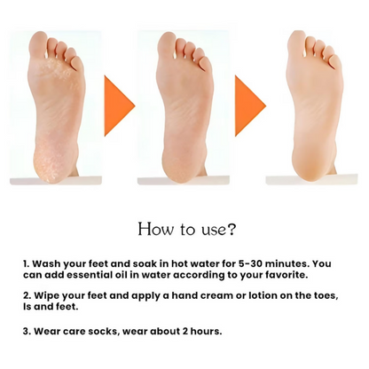 Bronson Professional Smiling Foot Anti Crack Silicone Socks - Dista